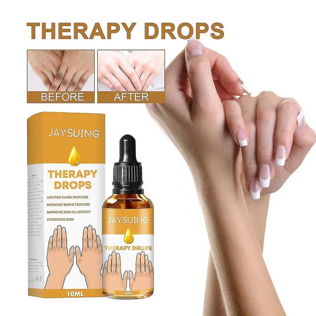 Nigricare Therapy Drops Acanthosis Nigricans Dark Spot Corrector Oil 3pcs on Productcaster.