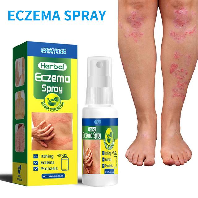 Anti-jeuk Plant Extractie Spray Gezondheid Lichaamsverzorging Antibacteriële oplossing Geschikt voor alle huidtypes A on Productcaster.