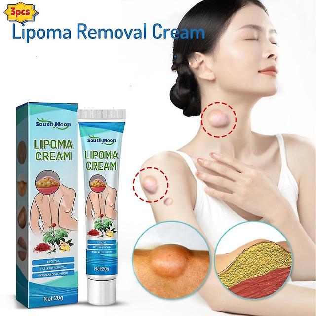 3x Novo Creme de Remoção de Lipoma Lipoma Tratar Creme de Deslipidação Inchaço da Pele on Productcaster.