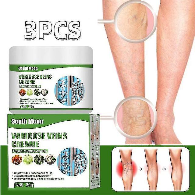 Shihaodian 3pcs South Moon Vein Repair Cream Earthworm Leg Vein Raised To Relieves Pain And Red on Productcaster.