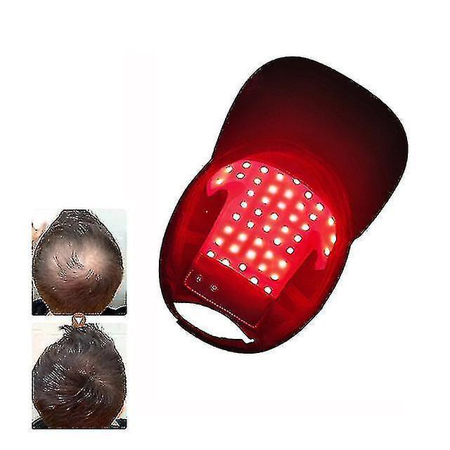 Unbrand Great Red Light Therapy Device Hair Growth Cap Anti Hair Loss Hair Growth Laser Helmet The Best Choice on Productcaster.