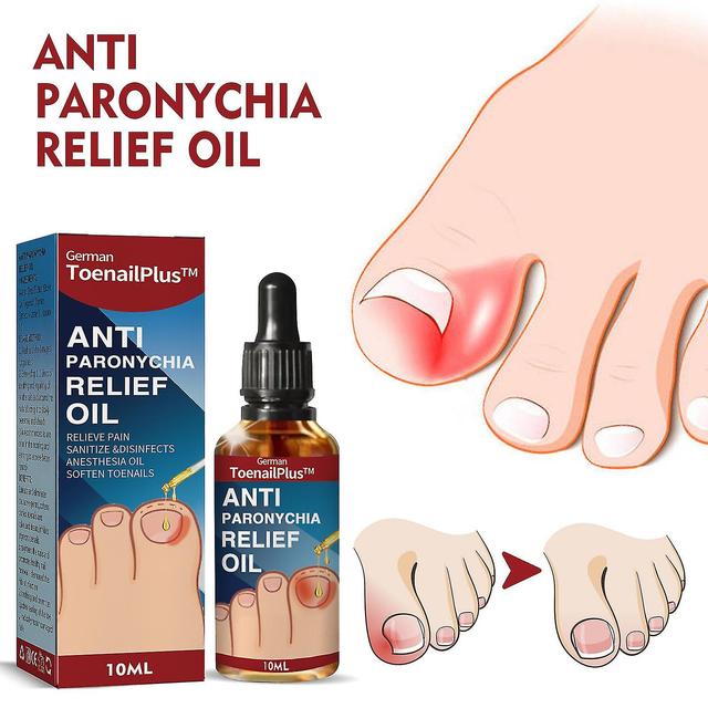 Lbh Anti-ongles Ditch Relief Oil Onychomycosis Nail Ditch Care Oil 3pcs on Productcaster.