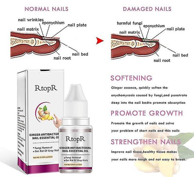 Rtopr Natural Herbal Tratamientos Antibacterianos para uñas Aceite Esencial 10ml on Productcaster.