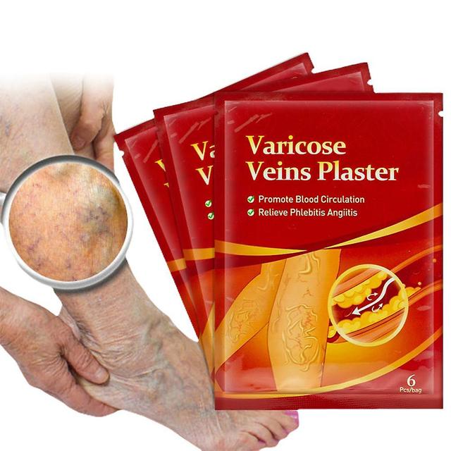 Varicose Veins Stickers Náplasť na hojenie kŕčových žíl - podporuje krvný obeh, 6KS on Productcaster.