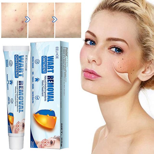 20g Bee-Venom Skin Warts Remover Cream Portable Improve Flesh Moles Crème pour usage externe 2pcs on Productcaster.