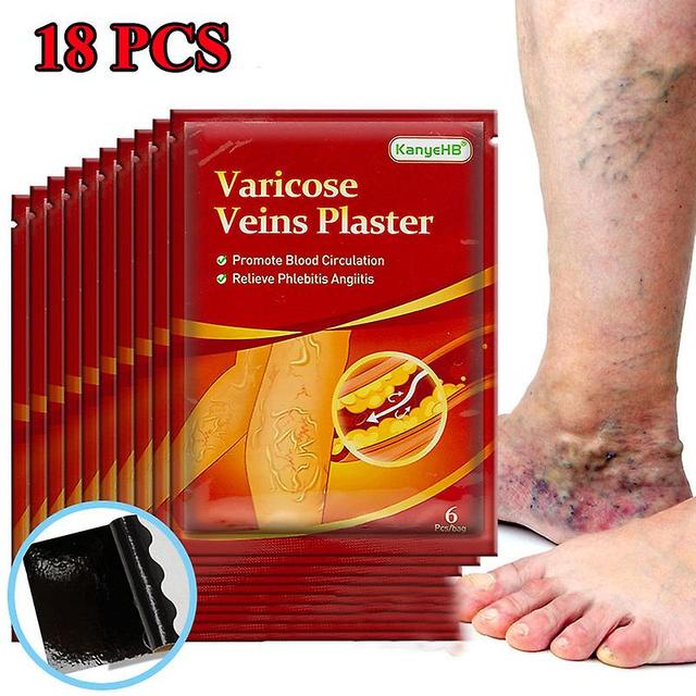 Qian 18pcs Krampfadern Ointmnet Vaskulitis Phlebitis Spinnencreme Krampfadern Angiitis Entfernung Kräuter Medizinisches Pflaster Gesundheitsfürsorg... on Productcaster.