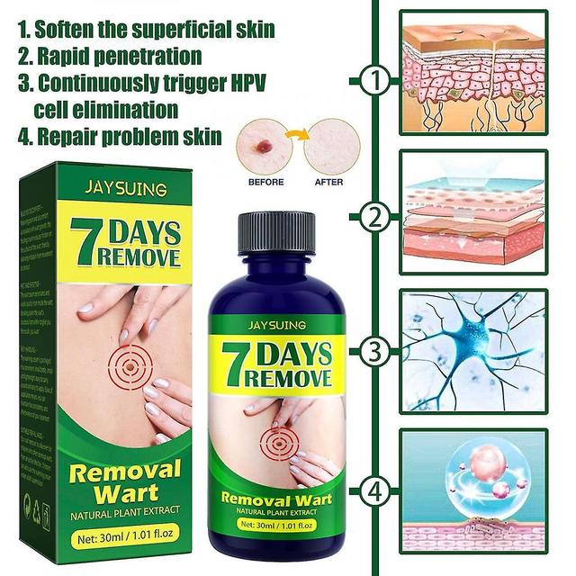 Wart Removing Essence, Warts And Corns, External Use Of Filamentous Warts, Smoothing Thorn Warts Essence VQF 1pcs on Productcaster.