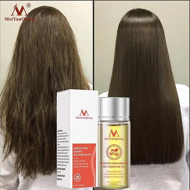 Ninesun Hair Growth Essential Oil Fast Powerful Hair Loss Products Essential Oil Liquid Treatment Preventing Hair Loss Hair Care on Productcaster.