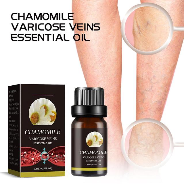 10ml Varicose Vein Relief Essential Oil Blood Circulation Promotion Oil for Leg Vein Protection Treatment A on Productcaster.