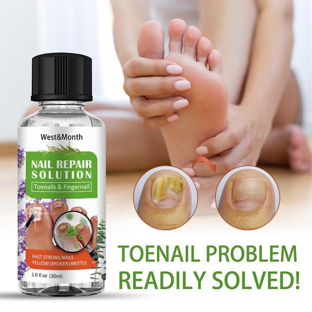 Baodan Oil Toenail Repair Fluid for Damaged Discolored Yellow Nails 30ml on Productcaster.