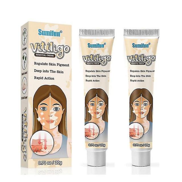 2ks Bylinný extrakt Vitiligo masť Odstráňte kožného ochorenia Odstránenie bielej škvrny Kožný vitiligo Eliminujte krém na ošetrenie vitiliga on Productcaster.