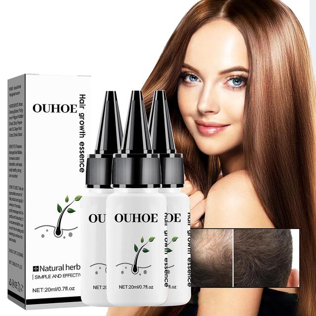 Szbght 3pcs Hair Growth Essence Advanced Thinning Hair & Hair Loss Supplement 30ml 20ml on Productcaster.