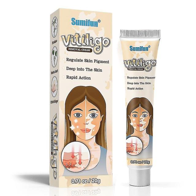 Lgigi Herbal Extract Vitiligo Ointment Remove Ringworm White Spot Removal Skin Vitiligo Eliminate Vitiligo Treatment Cream on Productcaster.