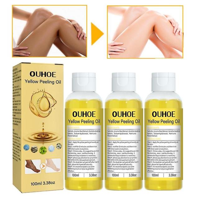 3x Yellow Peeling Oil Double Strength 100ml on Productcaster.