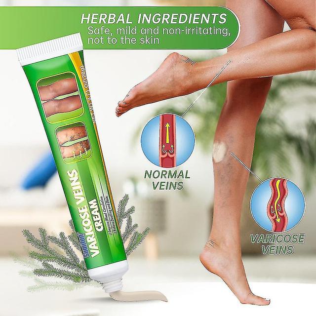 Varicose Vein Cream For Spider Veins Varicose Veins Removal Leg Care on Productcaster.