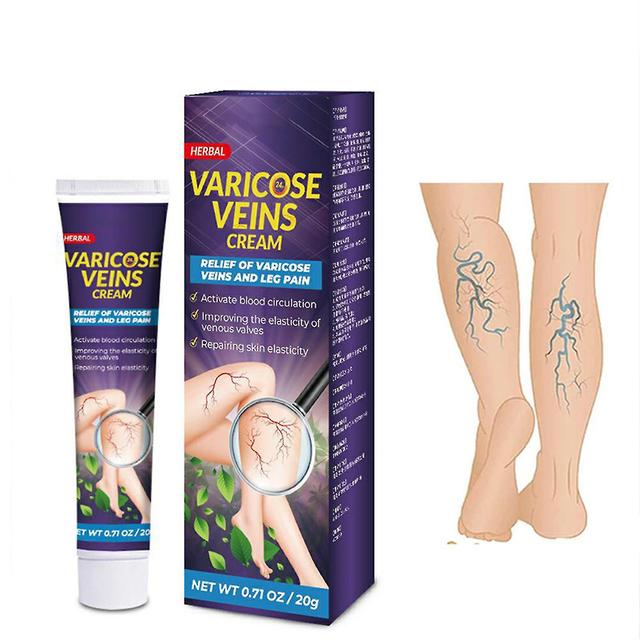 Varicose Veins Cream, Varicose Vein Ointment, Against Spider Veins Varicose Veins Cream, Against Spider Veins Legs Care Ointment 1pcs on Productcaster.