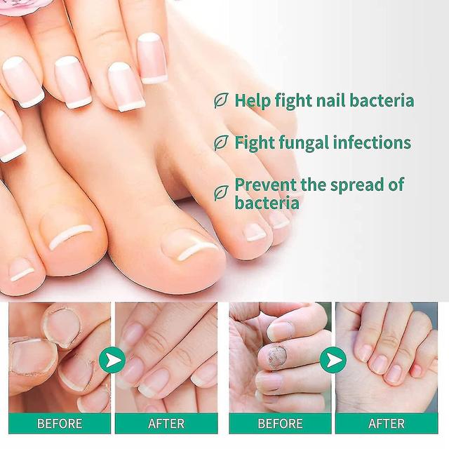 Kerassentials Toenail Fungus Treatment, Kerassentials Frisk hud Hår Naglar Kerassentials för Toen on Productcaster.