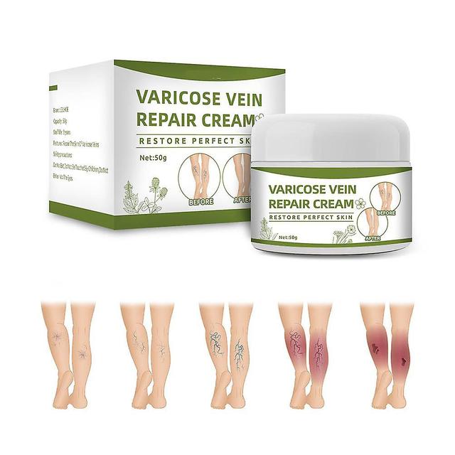 Boring Trading Varicose Veins Cream Natural Ointment for Varicose and Spider Veins Removal Spider Veins on Productcaster.