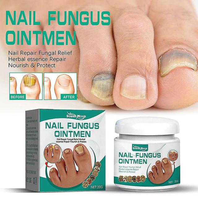 Verzorging crème voor voeten, anti-infectie, extreem krachtige behandeling tegen nagels paddenstoelen, nagels en tenen poeder on Productcaster.