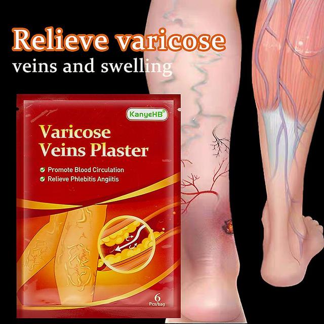 Qian 18/30/42/60pcs Varizes Varicose Veias Ointmnet Vasculitis Phlebitis Spider Cream Varicosity Angiitis Remoção Herbal Medical Plaster 30pcs em 5... on Productcaster.