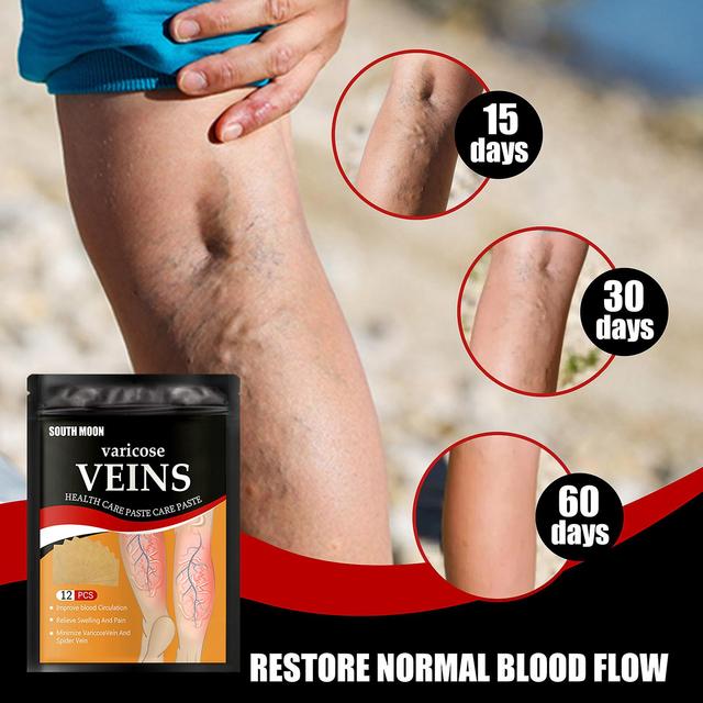 South Moon Vein Health Patch Relieves varicose vein blockage and raised cold compress vein health patch in the feet Massage Oil1PCS) 6PCS on Productcaster.