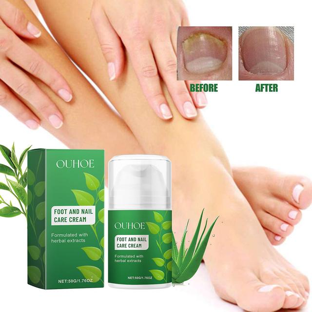 Haobuy Foot And Nail Care Cream, Herbal Extracts Foot and Nail Care Ointment for Daily Use, Mizonil Cream 1pcs on Productcaster.