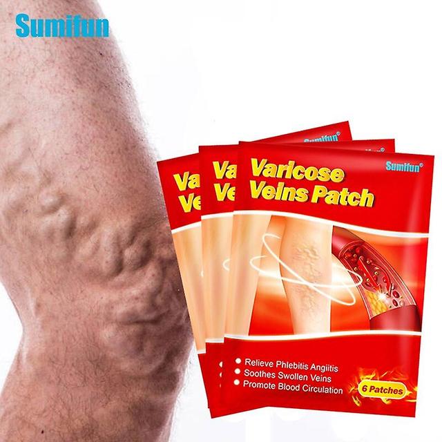 Coscelia Sumifun 6pcs/bag Varicose Veins Patch Leg Vasculitis Phlebitis Spider Leg Medical Plaster Angiitis Removal Chinese Herbal Patch 6pcs 1bag on Productcaster.