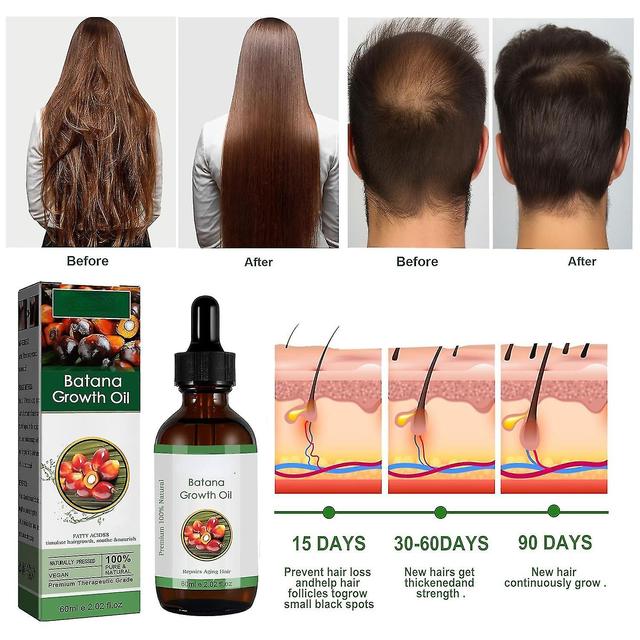 Batana Oil Organic For Healthy Hair,atana Oil For Hair Growth,100% Natural, Promotes Hair Wellness For Men & Women Enhances Hair & Skin Radiance 2 Pcs on Productcaster.