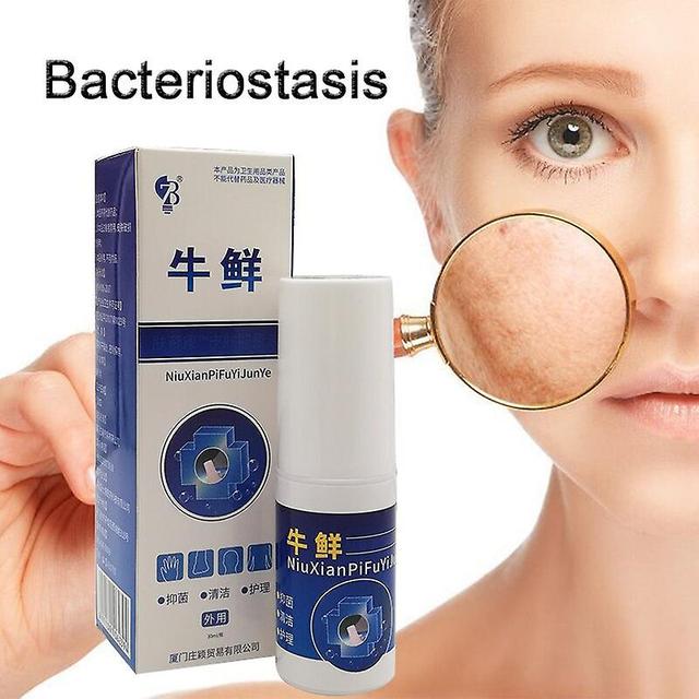 Fsu 30ml Chinese Herb Treatment Psoriasis Spary Relief Fungal Infections Foot Ringworm Psoriasi Eczma Lquid Health Skin Care 1pcs on Productcaster.