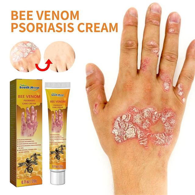 Psoriasis creme fjernelse psoriasis eksem bedst mod psoriasis dermatitis produkter naturlige planteekstrakter Pack 1 on Productcaster.