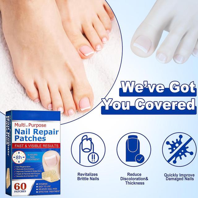 Toenail Fungus Treatment, 60pcs Patches, 8-hour Fungus For Damaged Nails Restores Healthy Appearance 4 Set - 240pcs on Productcaster.