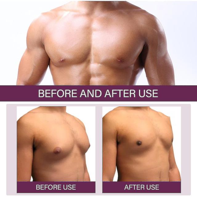 Gynecomastia Reduction Cellulite Spray,organic Men Chest Fat Reduction Spray 2Pcs on Productcaster.