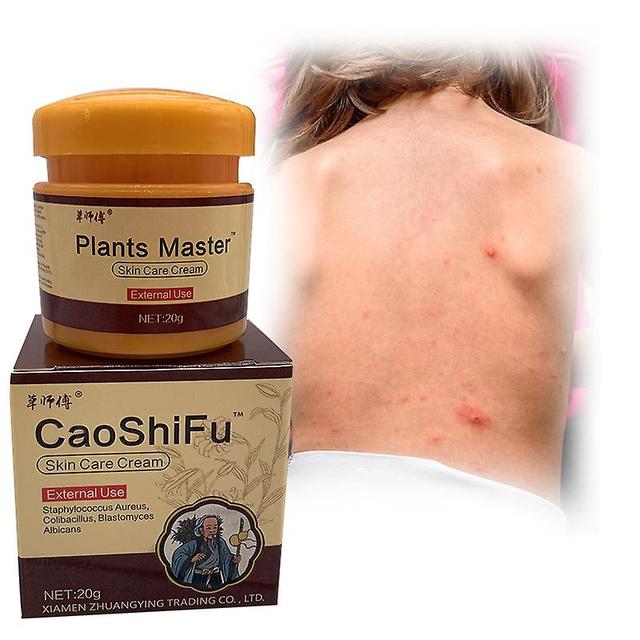 Coscelia 20g/pcs Caoshifu Psoriasis-Salbe Professionelle Heilung Ekzemkräuter Pflanzen Inhaltsstoffsicherheit für alle Arten von Hautproblemen on Productcaster.