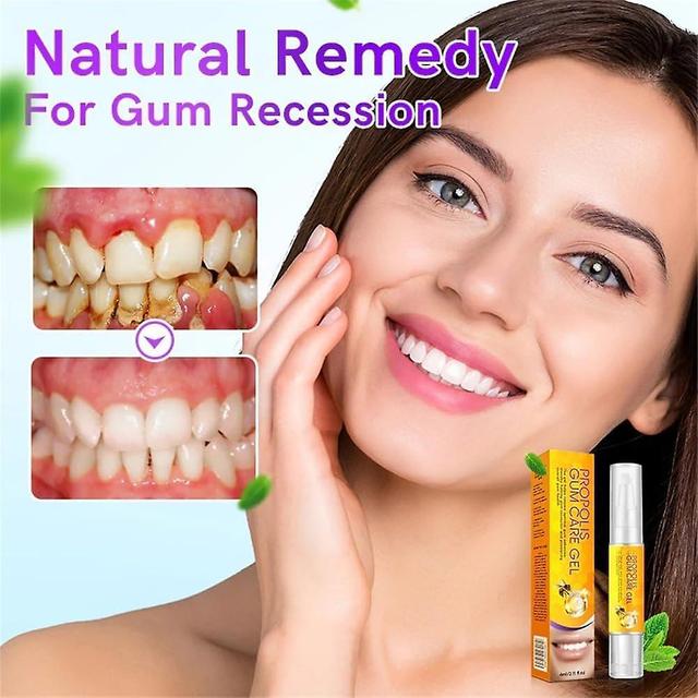 Antbaba Propolis Gum Care Gel, Propolis Gum Regrowth Gel, Propolis Teeth Regrowth Dental Gel, Natural Remedy for Gum Recession, Enhances Overall Gu... on Productcaster.