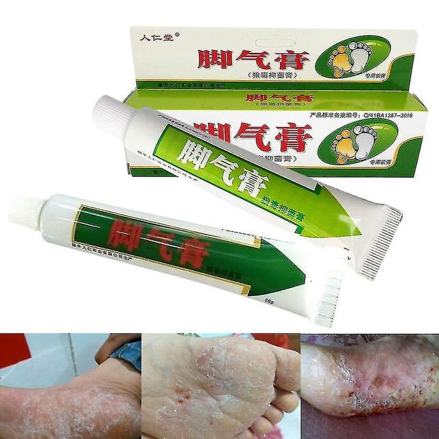 Ninefox Snake Venom Protease Ointment Stubborn Psoriasis Dermatitis Chronic Eczema on Productcaster.