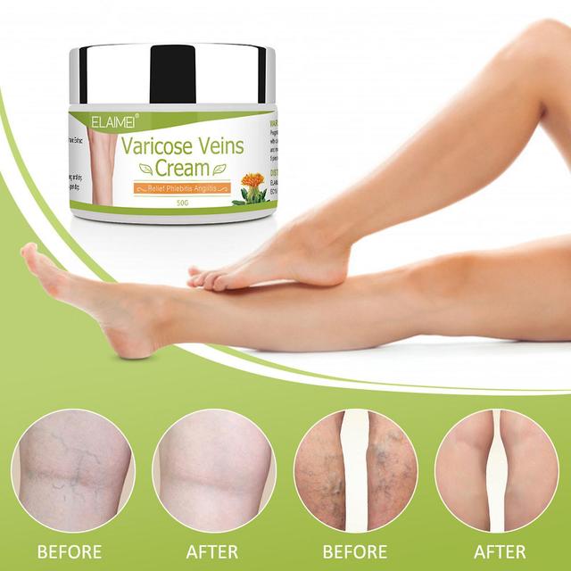 unbrand Vein Cream Veins And Bulge Relieve Pain Red Streak Repair Multicolor on Productcaster.