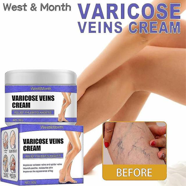 30g Vein Leg Care Crèmes Décolorantes Varices Crème Réparatrice on Productcaster.