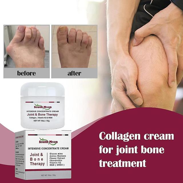 Szlld Joint Bone Collagen Cream For Joint Bone Pain Relief, Deformation Correct Relieve Joint Pain white1 on Productcaster.