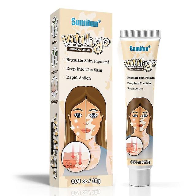 De kruidenzalf van Vitiligo van het Uittreksel verwijdert de Witte Vlekverwijdering van de Ringworm Witte Vlek Huid Vitiligo elimineert Vitiligobeh... on Productcaster.