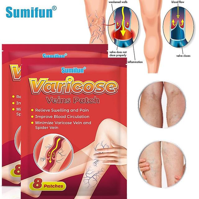 Coscelia 8 ~ 80pc Sumifun Vein Health Medicine Sticker Treat Phlebitis Varicosa Vasculitis Spider Legs Aliviar la oclusión de la esclerosis vascula... on Productcaster.