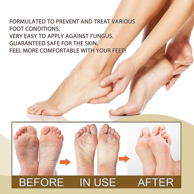 Fastaid Anti Fung Al Treat Ment Spray, Herbal Antipruritic Nail Fun_gus Beriberi Spray, Foot Fun_gus Infec_tions Toenail Repair Solution Foot Care on Productcaster.