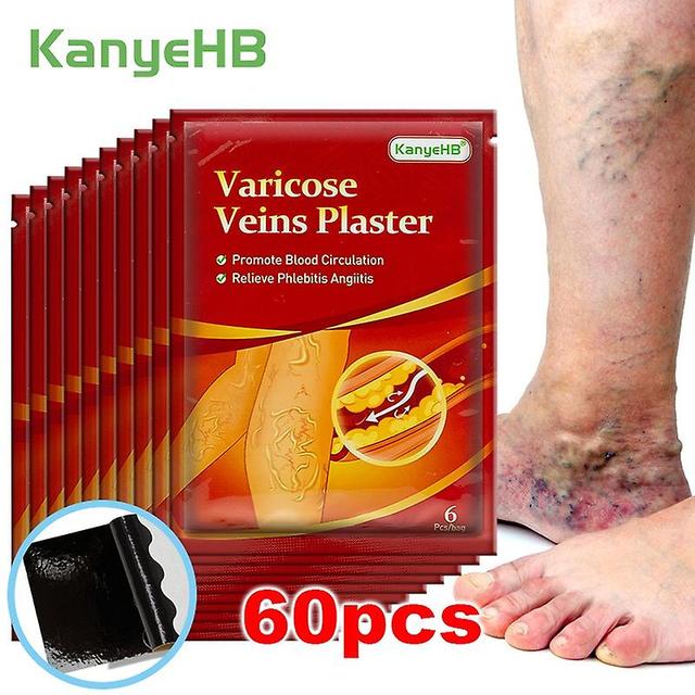 Ronaldo 18/30/42/60pcs Varicose Veins Ointmnet Vasculitis Phlebitis Spider Cream Varicosity Angiitis Removal on Productcaster.