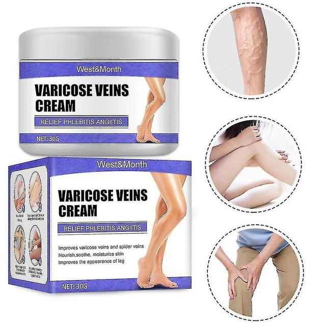 Cream Vein Effective Varicose Relief Relieve Veins Vasculitis Phlebitis on Productcaster.