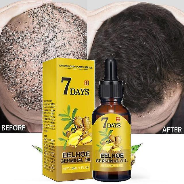 Hair Growth Products Ginger Fast Growing Hair Essential Oil Beauty Hair Care Pre 15g on Productcaster.