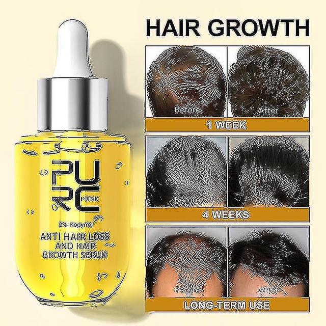 Purc Products Ginger Fast Grow Oil Anti Nourishing For Men Women Care Tw on Productcaster.