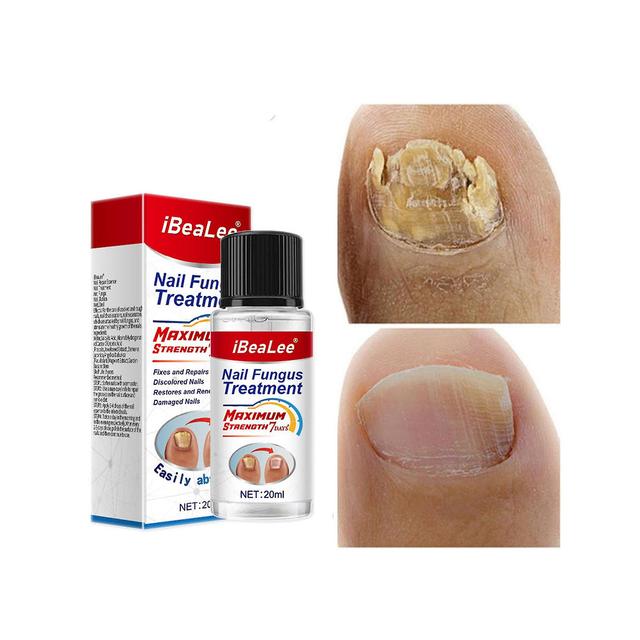 Flye 20ml Nail Essential Oil,liquid For Onychomycosis Unguent For Thickening Soft Nails Multicolor on Productcaster.