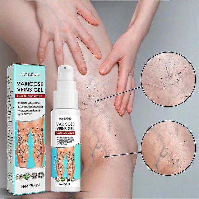 30ml Varicose Vein Massage Gel Maikang Earthworm Hamstring Vein Relax Gel Relieves Leg Pain Mike 2Pcs on Productcaster.