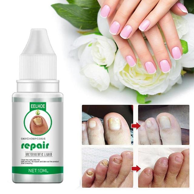 30ml Nails Repair Essence Liquid Nail Renewal Liquid For Toenail Fingernail on Productcaster.