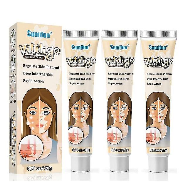 3st Örtextrakt Vitiligo Salva Ta bort Ringorm Vitfläcksborttagning Hud Vitiligo Eliminera Vitiligo Behandlingskräm on Productcaster.