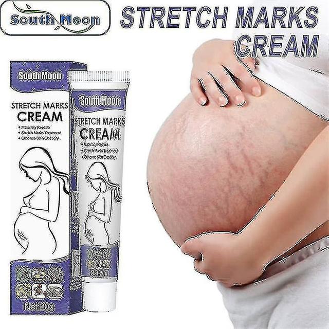 Fast Delivery Pregnancy Repair Cream Stretch Mark Removal Acne Scar Maternity Stretch Marks Remove Fat Striae Scars Treatment Firm Body Care on Productcaster.